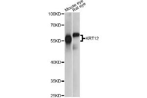 Western blot analysis of extracts of various cell lines, using KRT12 antibody. (KRT12 anticorps)