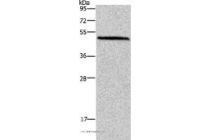 Western blot analysis of Mouse brain tissue, using HOMER1 Polyclonal Antibody at dilution of 1:400 (HOMER1 anticorps)