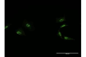 Immunofluorescence of monoclonal antibody to MED4 on HeLa cell.