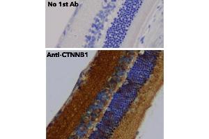 Immunohistochemistry (IHC) image for anti-Catenin, beta (CATNB) (C-Term) antibody (ABIN6254224)