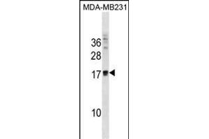 ANKRD37 Antibody (C-term) (ABIN1881057 and ABIN2838411) western blot analysis in MDA-M cell line lysates (35 μg/lane). (ANKRD37 anticorps  (C-Term))