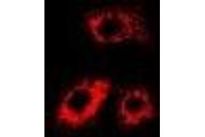 Immunofluorescent analysis of Citrate Synthase staining in MCF7 cells.