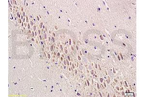 Formalin-fixed and paraffin embedded rat brain labeled with Anti-SEMA7A/CD108 Polyclonal Antibody, Unconjugated (ABIN749363) at 1:200 followed by conjugation to the secondary antibody and DAB staining (SEMA7A anticorps  (AA 351-450))