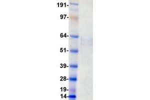 Validation with Western Blot