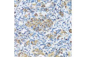 Immunohistochemistry of paraffin-embedded rat ovary using F antibody (ABIN3016158, ABIN3016159, ABIN3016160 and ABIN6219586) at dilution of 1:100 (40x lens).