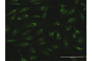 Immunofluorescence of purified MaxPab antibody to GOLGA5 on HeLa cell.