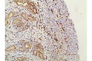 ABIN6267452 at 1/100 staining rat uterine tissue sections by IHC-P.