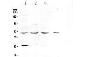 Western blot analysis of SPHK2 using anti-SPHK2 antibody . (SPHK2 anticorps  (AA 215-269))