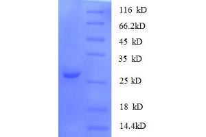 SDS-PAGE (SDS) image for S100 Calcium Binding Protein A11 (S100A11) (AA 2-105) protein (His-SUMO Tag) (ABIN5710294)