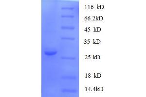 SDS-PAGE (SDS) image for S100 Calcium Binding Protein A11 (S100A11) (AA 2-105) protein (His-SUMO Tag) (ABIN5710294)