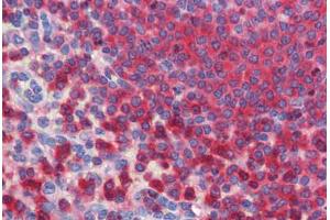 Human Spleen (formalin-fixed, paraffin-embedded) stained with  antibody ABIN462273 followed by biotinylated secondary antibody, alkaline phosphatase-streptavidin and chromogen. (Glucose-6-Phosphate Dehydrogenase anticorps  (AA 35-506))