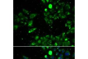 Immunofluorescence analysis of U2OS cells using UQCRFS1 Polyclonal Antibody (UQCRFS1 anticorps)