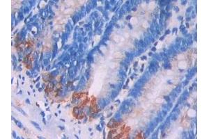 Detection of LAMP2 in Rat Small intestine Tissue using Polyclonal Antibody to Lysosomal Associated Membrane Protein 2 (LAMP2)