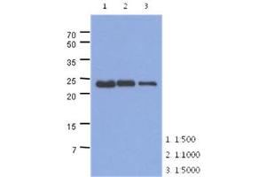 The extracts of mouse muscle (40ug) were resolved by SDS-PAGE, transferred to PVDF membrane and probed with anti-human TNNI1 antibody (1:500 ~ 1:5000). (TNNI1 anticorps)