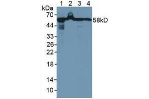 Western blot analysis of (1) Rat Liver Tissue, (2) Rat Pancreas Tissue, (3) Human A549 Cells and (4) Human MCF Cells. (HSPD1 anticorps  (AA 1-573))