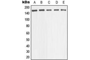 Western blot analysis of nNOS expression in HeLa (A), Raw264. (NOS1 anticorps  (Center))