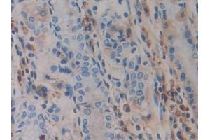 Detection of ADAM10 in Human Stomach Tissue using Polyclonal Antibody to A Disintegrin And Metalloprotease 10 (ADAM10)