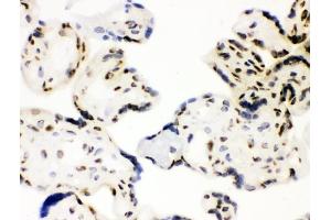 IHC analysis of XRCC1 using anti-XRCC1 antibody (ABIN5693138).