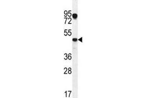 VEGFC antibody western blot analysis in MCF-7 lysate.