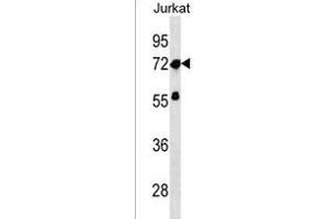 ZNF286A Antibody (Center) (ABIN1538091 and ABIN2850402) western blot analysis in Jurkat cell line lysates (35 μg/lane). (ZNF286A anticorps  (AA 213-239))