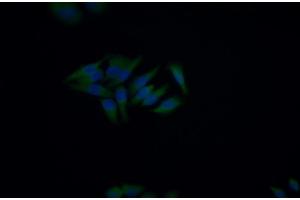 Detection of CD5 in Human HepG2 cell using Polyclonal Antibody to Cluster Of Differentiation 5 (CD5) (CD5 anticorps  (AA 25-372))
