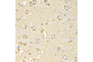 Immunohistochemistry of paraffin-embedded rat brain using TRAP1 Antibody (ABIN1875197) at dilution of 1:200 (40x lens). (TRAP1 anticorps)