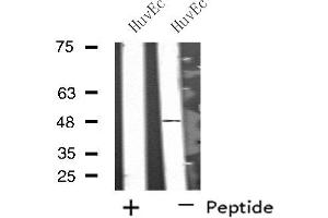 Western blot analysis of extracts from HuvEc cells, using SYT13 antibody. (SYT13 anticorps  (Internal Region))