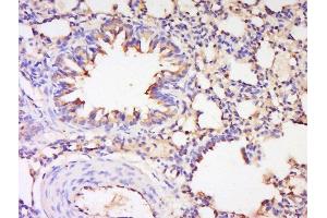 Formalin-fixed and paraffin embedded rat lung labeled with Anti-NOS-2/iNOS Polyclonal Antibody, Unconjugated  at 1:200 followed by conjugation to the secondary antibody and DAB staining.