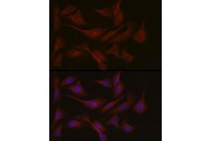 Immunofluorescence analysis of U2OS cells using NPHP1 Rabbit pAb (ABIN6128349, ABIN6144768, ABIN6144769 and ABIN6222377) at dilution of 1:50 (40x lens).