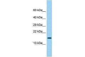 Host: Rabbit Target Name: LY6G6D Sample Type: Fetal Lung lysates Antibody Dilution: 1. (LY6G6D anticorps  (N-Term))