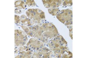 Immunohistochemistry of paraffin-embedded human stomach using NMU antibody (ABIN6290689) at dilution of 1:100 (40x lens). (Neuromedin U anticorps)