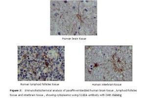 Image no. 1 for anti-S100 Calcium Binding Protein A1 (S100A1) antibody (ABIN232125) (S100A1 anticorps)