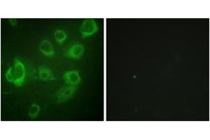 Immunofluorescence analysis of HuvEc cells, using Myosin regulatory light chain 2 (Phospho-Ser18) Antibody. (MYL12B anticorps  (pSer18))
