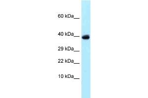 Western Blotting (WB) image for anti-Ubiquitin Specific Peptidase 4 (USP4) (C-Term) antibody (ABIN2789297)