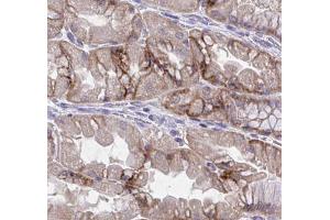 ABIN6277257 at 1/100 staining human kidney tissues  sections by IHC-P.