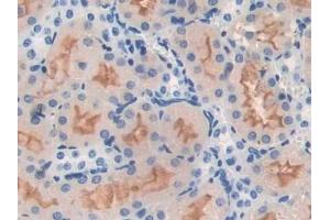 Detection of NOS1 in Mouse Kidney Tissue using Polyclonal Antibody to Nitric Oxide Synthase 1, Neuronal (NOS1)