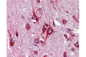 Anti-TFAP2C / AP2 Gamma antibody IHC of human brain, cortex.
