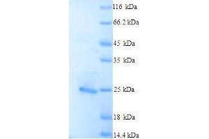 SDS-PAGE (SDS) image for BCL2-Like 11 (Apoptosis Facilitator) (BCL2L11) (AA 1-198), (full length) protein (His tag) (ABIN5713280)