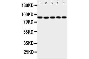 Western Blotting (WB) image for anti-Arachidonate 5-Lipoxygenase (ALOX5) (AA 650-667), (C-Term) antibody (ABIN3044238) (ALOX5 anticorps  (C-Term))