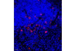 Immunofluorescence of paraffin embedded rat thymus using UBE3A (ABIN7076105) at dilution of 1:650 (400x lens)
