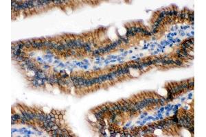 IHC analysis of RENT1/hUPF1 using anti-RENT1/hUPF1 antibody (ABIN3043955).
