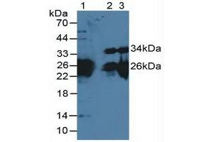 Figure. (MYL3/CMLC1 anticorps  (AA 8-199))