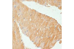 Immunohistochemistry of paraffin-embedded mouse heart using MYBPC3 antibody (ABIN6129601, ABIN6144221, ABIN6144222 and ABIN6215951) at dilution of 1:100 (40x lens).