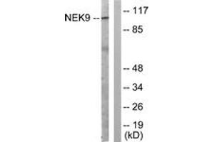 Western blot analysis of extracts from A549 cells, using NEK9 (Ab-210) Antibody. (NEK9 anticorps  (AA 176-225))