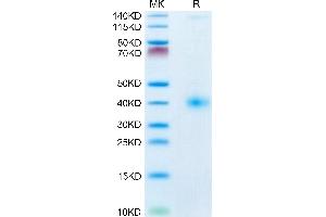 CD161 Protein (AA 67-225) (His tag)