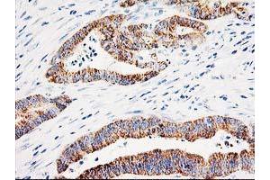 Image no. 8 for anti-Adenylate Kinase 4 (AK4) antibody (ABIN1496524)