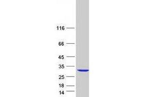 Validation with Western Blot