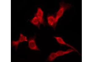 ABIN6276157 staining Hela by IF/ICC. (OR4K3 anticorps)