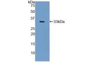 Detection of Recombinant KRT5, Mouse using Polyclonal Antibody to Cytokeratin 5 (CK5)