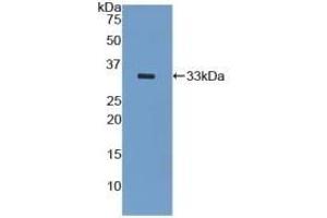 Detection of Recombinant KRT5, Mouse using Polyclonal Antibody to Cytokeratin 5 (CK5) (Cytokeratin 5 anticorps  (AA 163-471))